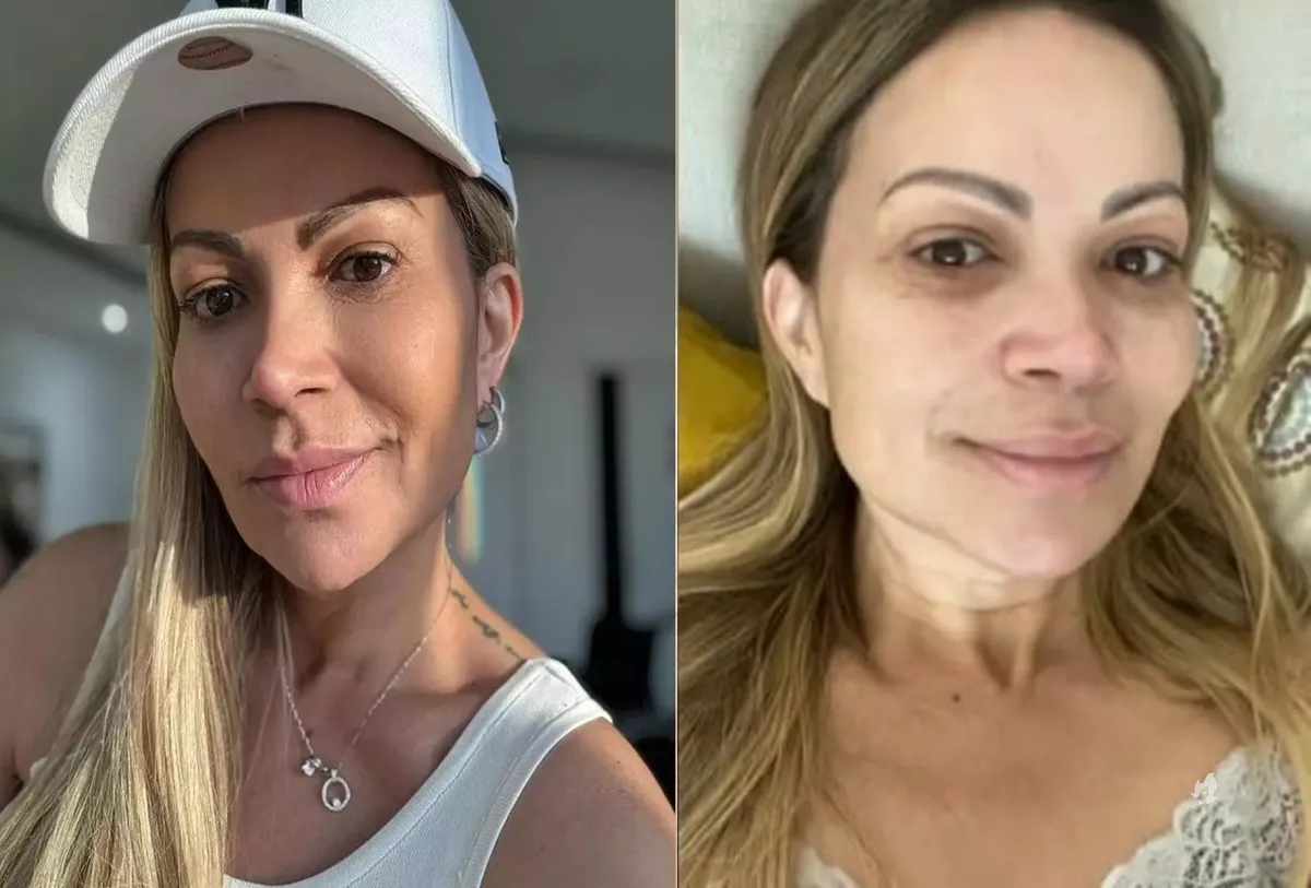 Medica entrega detalhe de tratamento para vicio de Solange