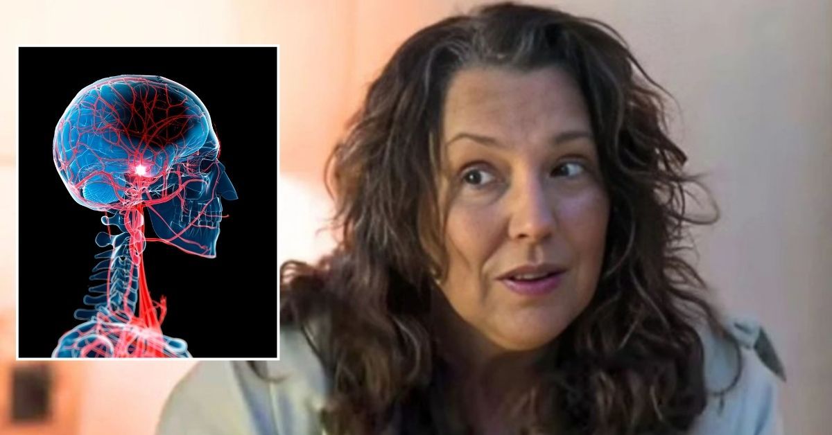 Médico revela as possíveis e graves complicações que a atriz Ana Beatriz Nogueira pode enfrentar com doença 31 Medico revela as possiveis e graves complicacoes que a atriz