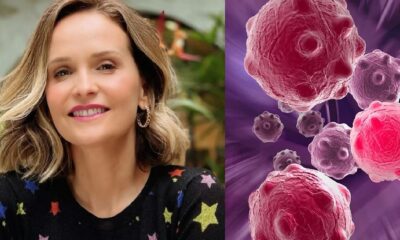 O que e carcinoma tumor maligno diagnosticado na atriz Fernanda