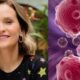 O que e carcinoma tumor maligno diagnosticado na atriz Fernanda