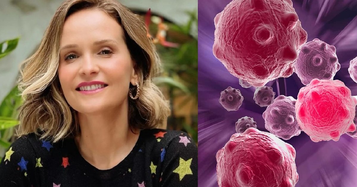O que e carcinoma tumor maligno diagnosticado na atriz Fernanda