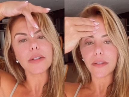 Poliana Rocha mostra veia na testa e faz suspense sobre remoção: “É incômodo” 31 Poliana Rocha mostra veia na testa e faz suspense sobre remoção: “É incômodo”