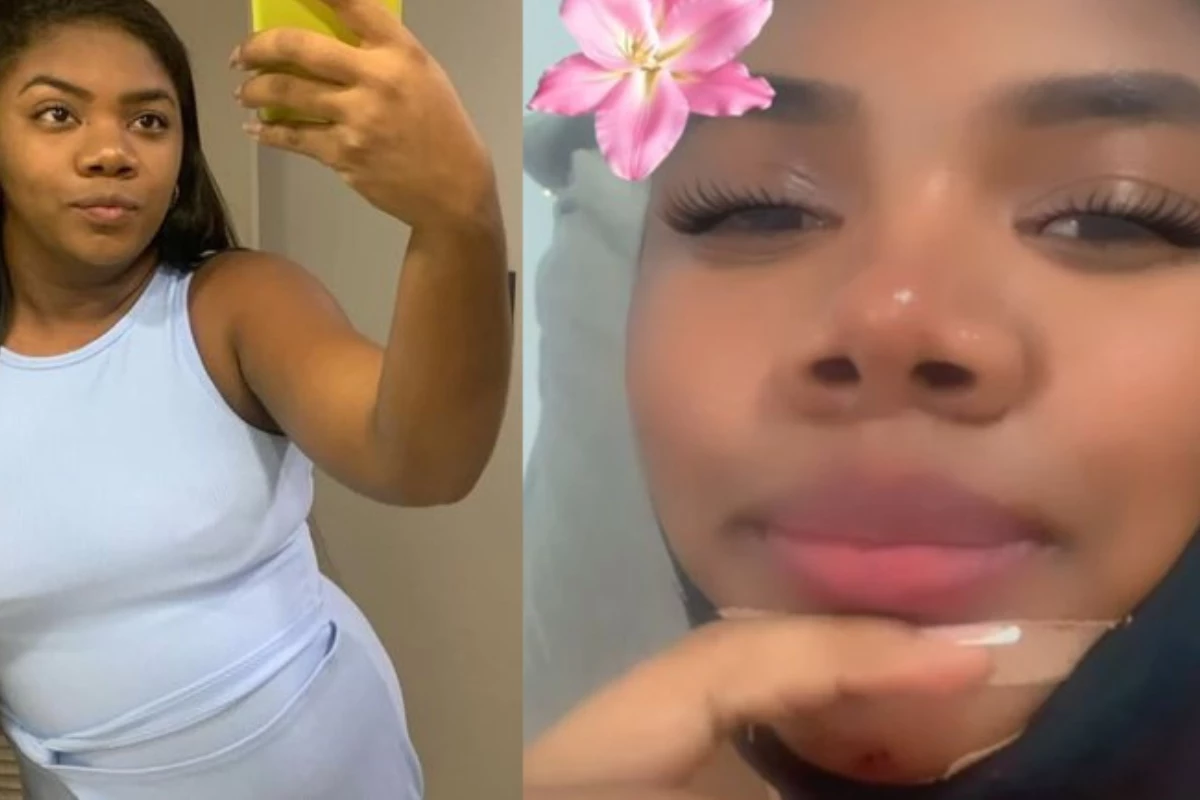 Raquel Brito revela que fez uma cirurgia plástica e dispara: ‘Me sentia feia demais’ 31 Raquel Brito revela que fez uma cirurgia plastica e dispara