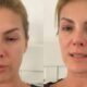 Record bate o martelo sobre futuro de Ana Hickmann apos