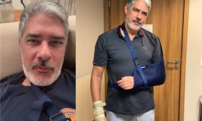 Video William Bonner sofre acidente explica o que houve e