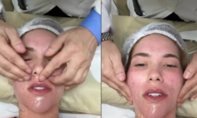 Virginia Fonseca aparece com o rosto deformado e da detalhes