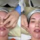 Virginia Fonseca aparece com o rosto deformado e da detalhes