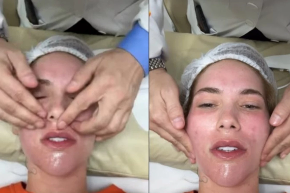 Virginia Fonseca aparece com o rosto deformado e dá detalhes sobre sua recuperação: ‘Não se assustem…’ 31 Virginia Fonseca aparece com o rosto deformado e da detalhes