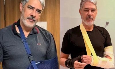 William Bonner apresentara o Jornal Nacional com o braco quebrado