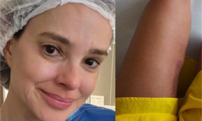 ‘Tenho sofrido esposa de Rodrigo Faro mostra cicatriz e diz