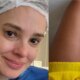 ‘Tenho sofrido esposa de Rodrigo Faro mostra cicatriz e diz