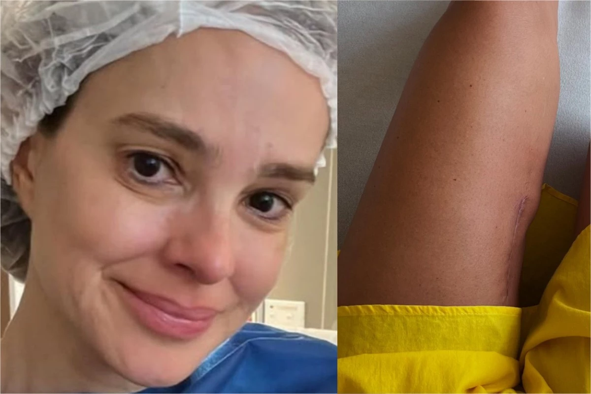 ‘Tenho sofrido’: esposa de Rodrigo Faro mostra cicatriz e diz que não tem vergonha 31 ‘Tenho sofrido esposa de Rodrigo Faro mostra cicatriz e diz