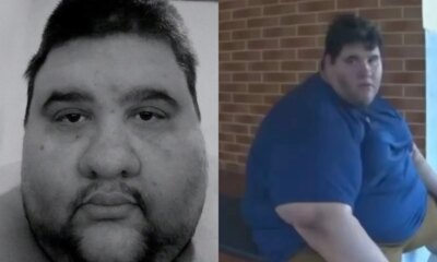 Causa do obito do influenciador que lutava contra a obesidade