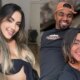 Cirurgia dentista que esta namorando Davi Brito rompe o silencio apos