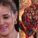 Com cancer raro Vera Viel mostra cicatrizes apos radioterapia e