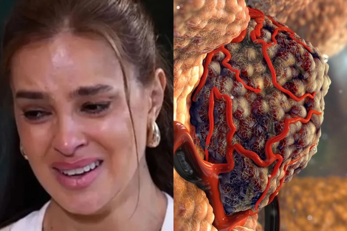 Com câncer raro, Vera Viel mostra cicatrizes após radioterapia e detalhe emociona: ‘Depois da última…’ 33 Com cancer raro Vera Viel mostra cicatrizes apos radioterapia e