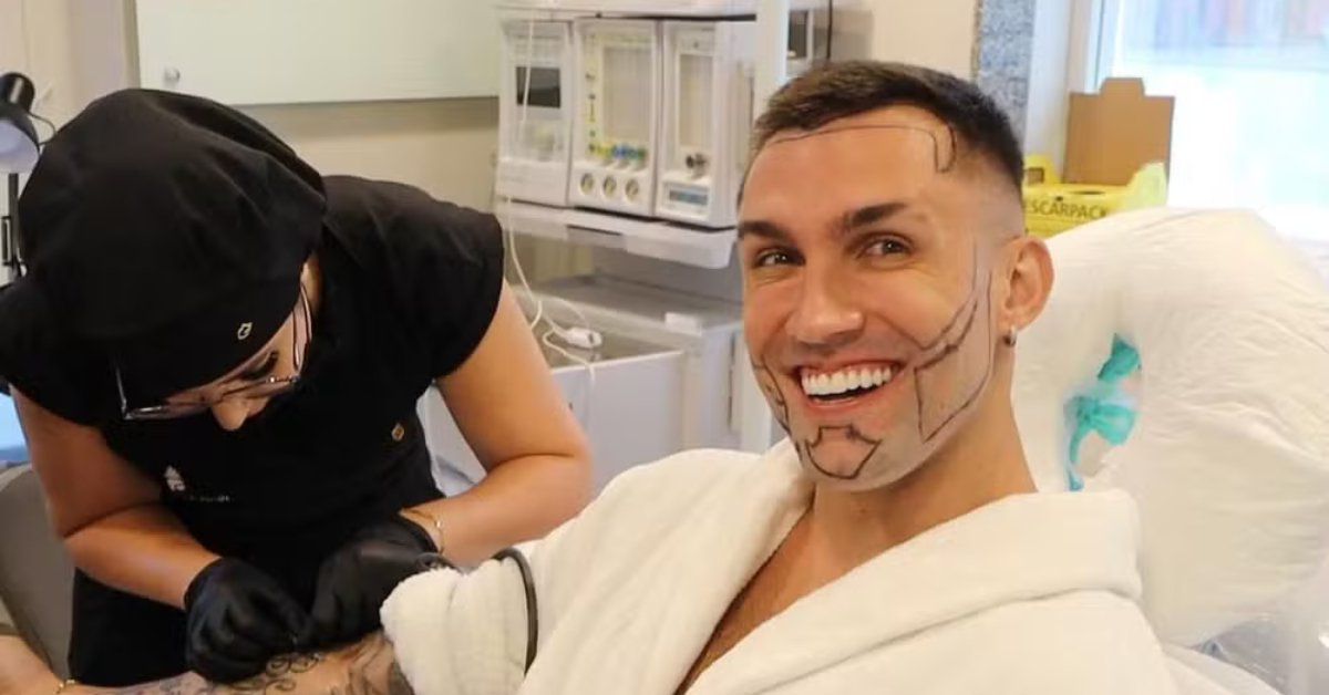 Ex-BBB Arthur Picoli mostra resultado e explica decisão de fazer transplante de cabelo e barba 31 Ex BBB Arthur Picoli mostra resultado e explica decisao de fazer