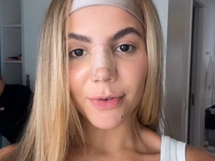 Ex-BBB Hariany se arrepende de procedimento com PMMA: “Efeitos irreversíveis” 31 Ex BBB Hariany se arrepende de procedimento com PMMA Efeitos irreversiveis