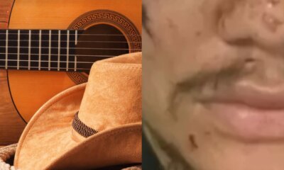 Famoso cantor sertanejo e espancado e surge irreconhecivel ao ser
