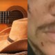 Famoso cantor sertanejo e espancado e surge irreconhecivel ao ser