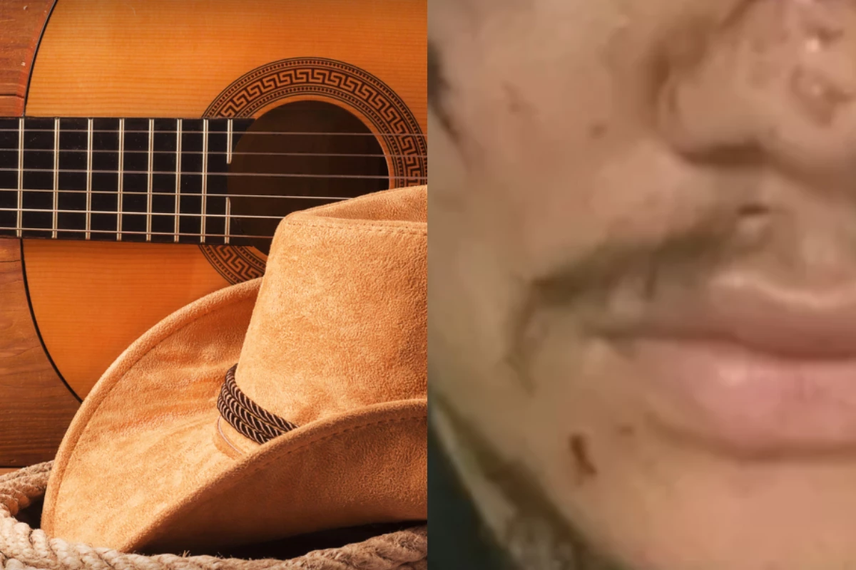Famoso cantor sertanejo é espancado e surge irreconhecível ao ser desfigurado por agressor 33 Famoso cantor sertanejo e espancado e surge irreconhecivel ao ser