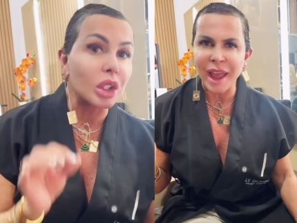 Gretchen posa sem mega hair e mostra realidade de sua alopecia 31 Gretchen posa sem mega hair e mostra realidade de sua
