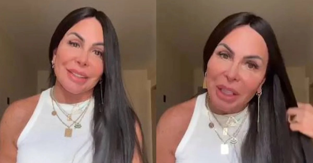 Gretchen remove mega hair e mostra fase do tratamento contra