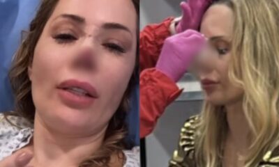 Influencer brasileira e atacada por cachorro e perde parte do