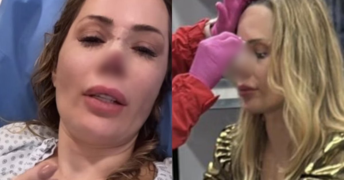 Influencer brasileira é atacada por cachorro e perde parte do nariz 31 Influencer brasileira e atacada por cachorro e perde parte do