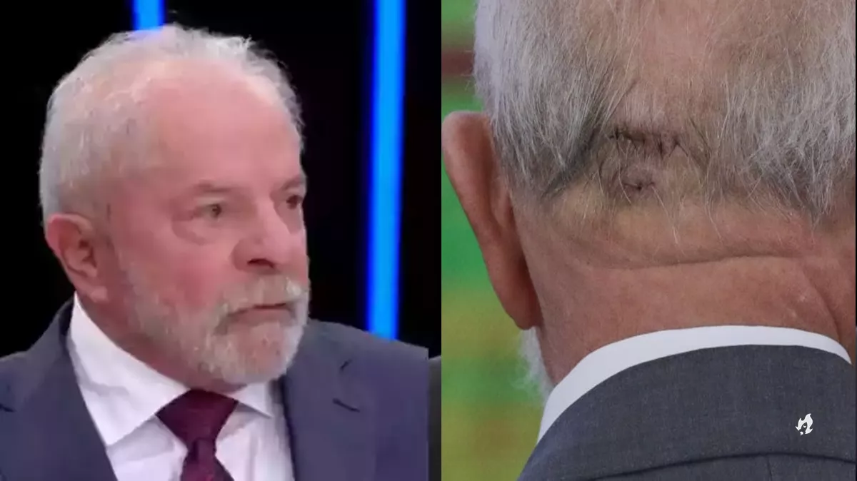 Lula faz novo exame resultado vem a tona e