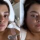 Lutando contra cancer Preta Gil faz desabafo apos cirurgia Nao
