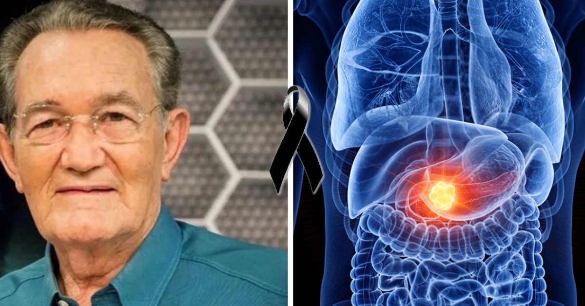 Sintomas, causas e tratamento do câncer de pâncreas que tirou a vida de Leo Batista 31 Sintomas causas e tratamento do cancer de pancreas que tirou