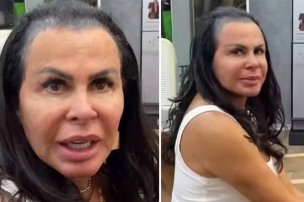 Vídeo: Gretchen revela luta contra calvície, explica causas e exibe transformação com mega-hair 31 Video mostra calvicie de Gretchen a cantora deu detalhes do