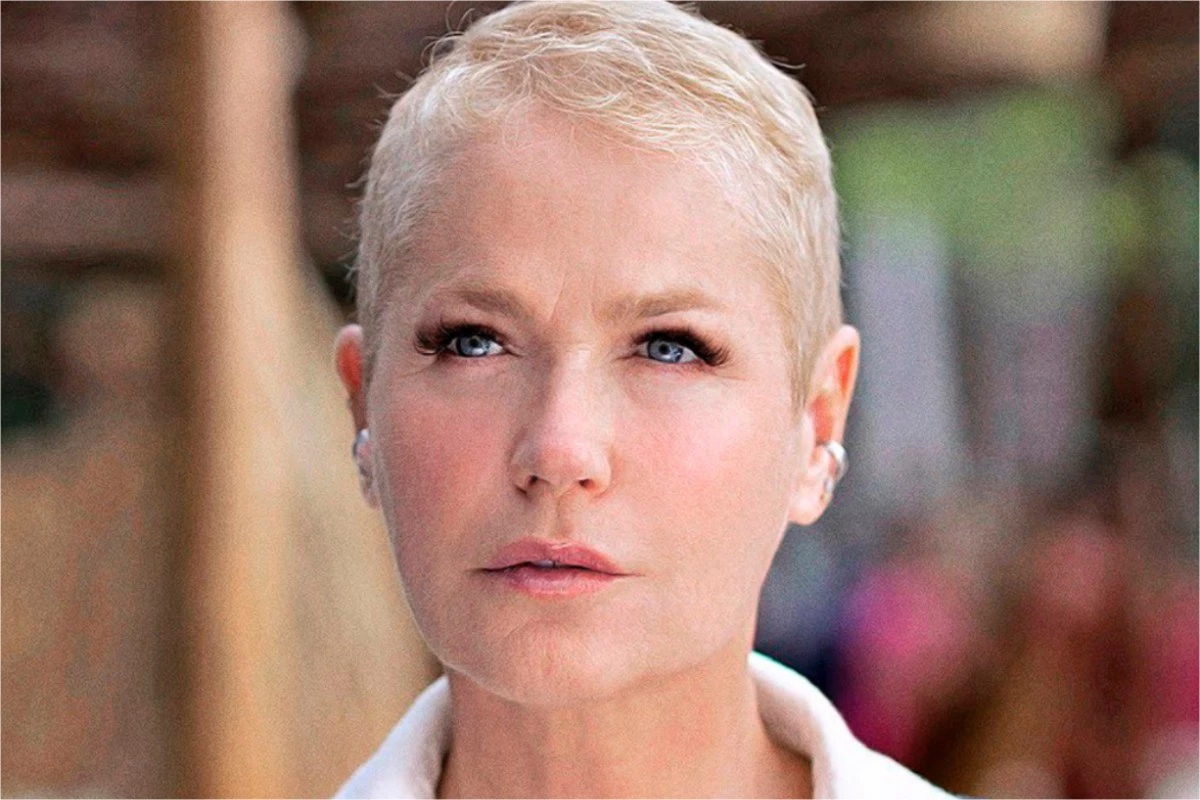 Xuxa Meneghel passa por cirurgia em São Paulo, e assessoria divulga comunicado 31 Xuxa Meneghel passa por cirurgia em Sao Paulo e assessoria