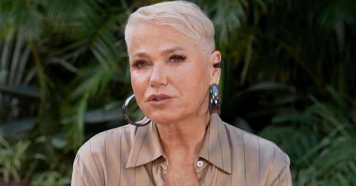 Xuxa Meneghel revela doença incurável e progressiva: 'As pessoas ficariam assustadas' 31 Xuxa Meneghel revela doenca incuravel e progressiva As pessoas ficariam