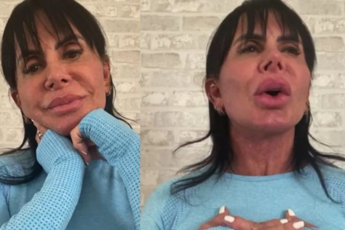 Gretchen mostra coragem e revela como está lidando com a alopecia: ‘Não é toda mulher que tem coragem’ 33 ‘Nao adianta eu tirar Gretchen revela conversa com medico antes