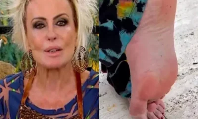 Ana Maria Braga fala pela 1a vez apos ser