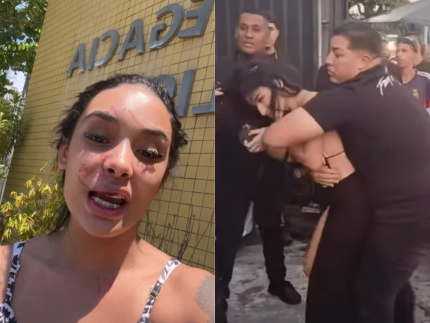 Com ferimentos no rosto, mulher agredida por Bia Miranda e amigos aponta “covardia” 31 Com ferimentos no rosto mulher agredida por Bia Miranda e