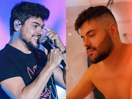 Cristiano, da dupla com Zé Neto, exibe resultado do implante de barba. Veja! 31 Cristiano da dupla com Ze Neto exibe resultado do implante