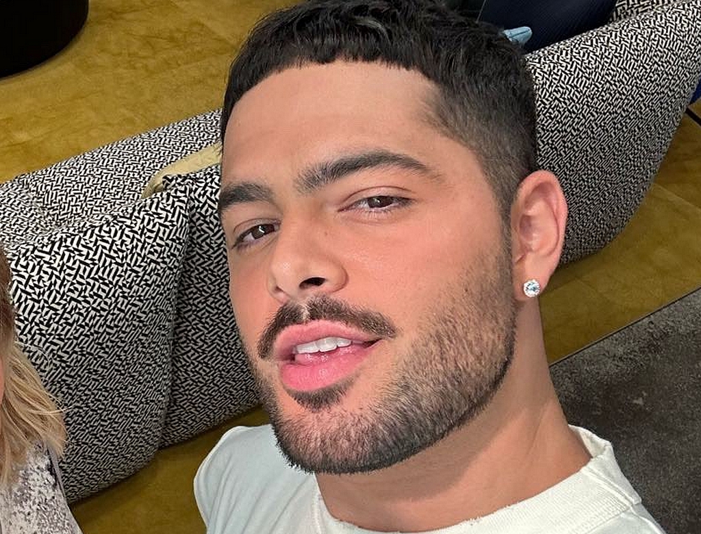 Entenda a cirurgia feita por Pedro Sampaio, que cancelou agenda de carnaval 37 Pedro Sampaio (foto Reprodução Redes Sociais)