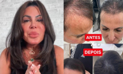 Gretchen mostra antes e depois da evolucao do cabelo apos