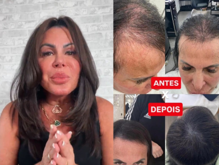 Gretchen mostra antes e depois da evolucao do cabelo apos