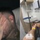 Kevinho deixa fas preocupados ao revelar problemas de saude e