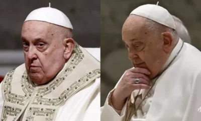 Papa Francisco necessita de almofadas nasais para aplicacao de