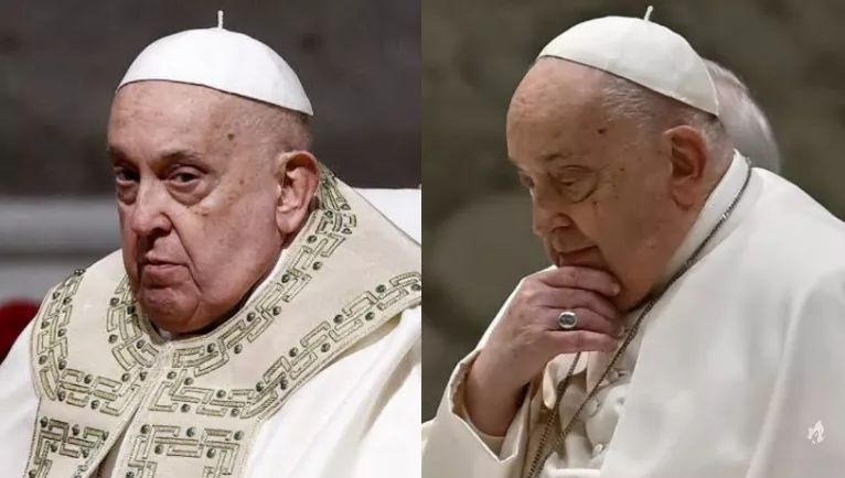 Papa Francisco necessita de almofadas nasais para aplicacao de