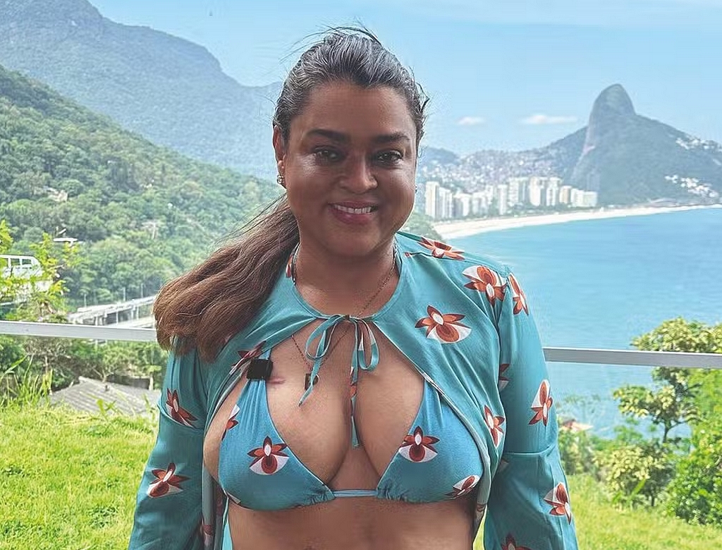 Preta Gil coloca bolsa de colostomia definitiva 37 Preta Gil (foto Reprodução Redes Sociais)