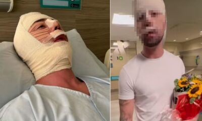 Rico Melquiades recebe alta apos passar por novo procedimento no