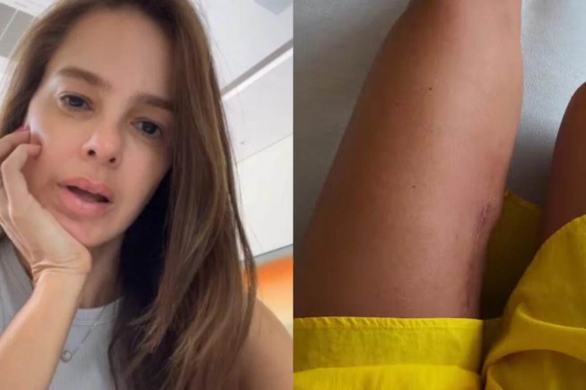 Vera Viel compartilha desafios em tratamento contra tumor raro: ‘Minha perna ficou diferente’ 31 Vera Viel compartilha desafios em tratamento contra tumor raro ‘Minha