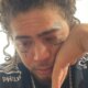 Whindersson Nunes e internado em clinica psiquiatrica e comunicado vem