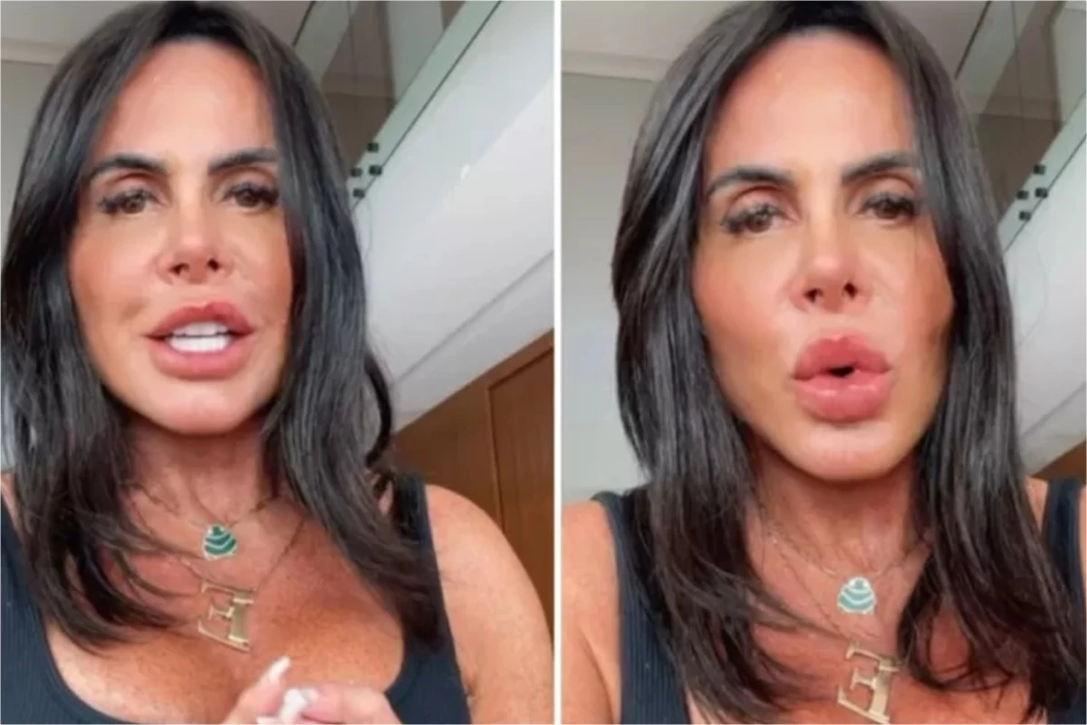 Com risco de necrose, Gretchen passa por cirurgia no rosto: ‘A gente removeu…’ 33 ‘Gretchen Convidando Todos para o Cabare da Cinderela cantora processa